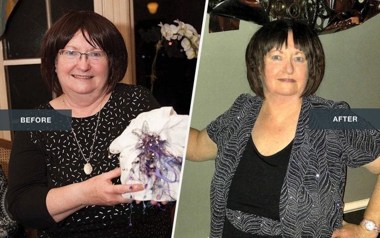 Losing Weight When You Physically Can’t Exercise: Doreen’s Journey